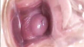 Girl's Tiring Doctor Visit: A Webcam Capture