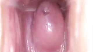 Girl's Tiring Doctor Visit: A Webcam Capture