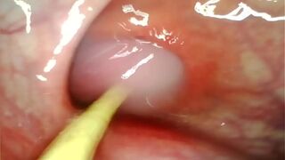 ANAL POV. CAMERA INSIDE HER ASSHOLE AS I POUND HER WITH MY BIG COCK AND CUM DEEP INSIDE