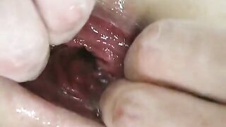 Amateur Anal: Stretching My Elastic Asshole