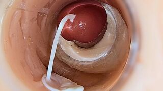 Camera Inside Deep Pussy Captures Huge Ejaculation of Sperm