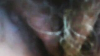 61-Year-Old Granny Ludmila From Belarus Shows Off Her Hairy Assets